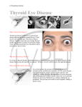 Thyroid Eye Disease - LV Prasad Eye Institute