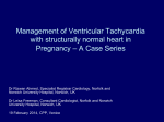 Management of Ventricular Tachycardia with structurally normal