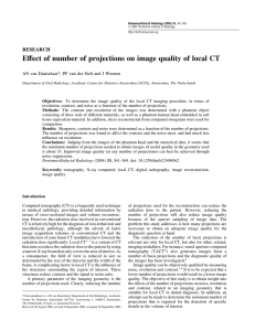Effect of number of projections on image quality of local CT