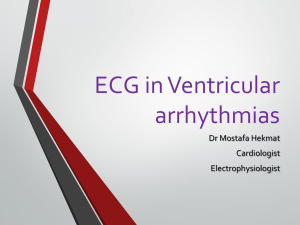 ECG in Ventricular arrhythmias
