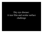 Dry eye disease