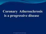 Coronary Atherosclerosis is a progressive disease