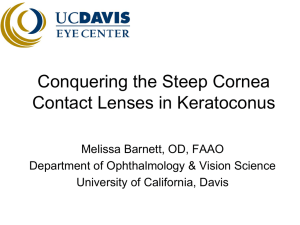 Conquering the Steep Cornea Contact Lenses