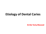 Etiology of Dental Caries