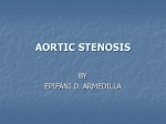 AORTIC STENOSIS - Ravenwood-PA