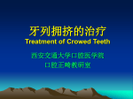 牙列拥挤的治疗 Treatment of Crowed Teeth 西安交通大学口腔医学院
