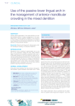 Use of the passive lower lingual arch in the management of anterior