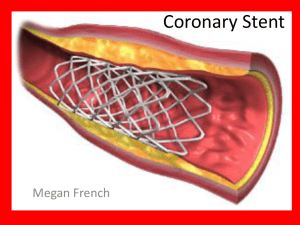 Cardiac Stent
