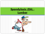 Spondylosis (OA) - Lumbar