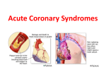 Acute Coronary Syndromes_2016_therapy lab