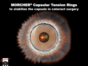 Morcher Capsular Tension Rings PowerPoint