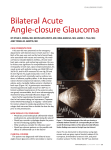 Bilateral acute angle-closure glaucoma