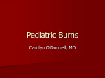 Care of Moderate and Severe Burns- pediatric