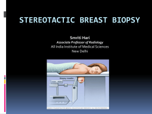 stereotactic breast biopsy