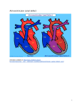 What is atrioventricular canal defect