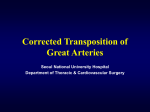 Corrected Transposition of the Great Arteries