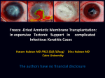 Freeze-Dried Amniotic Membrane Transplantation