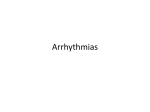 Arrhythmias - Ipswich-Year2-Med-PBL-Gp-2