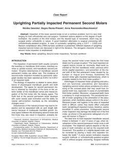 Uprighting Partially Impacted Permanent Second Molars