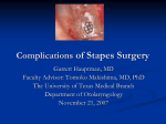 Complcations of Stapes Surgery