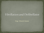 Fibrillation and Defibrillator