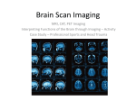 Brain Scan Imaging