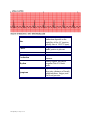 EKG Practice Strips File