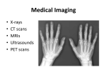 X-Ray imaging Used in many different ways in medical diagnosis. A
