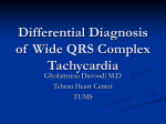 Differential Diagnosis of Wide QRS Complex Tachycardia