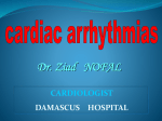 Sinus Tachycardia