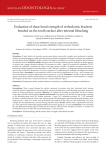 Evaluation of shear bond strength of orthodontic brackets bonded on