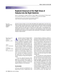 Ruptured Aneurysm of the Right Sinus of Valsalva Into the Right