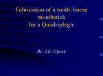 Fabrication of a tooth – borne mouthstick