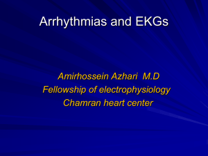 Arrythmias and EKGs