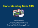 Understanding Basic EKG - Understanding EKG Basics