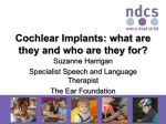Aided Hearing Thresholds: Cochlear implant