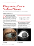 diagnosing ocular Surface disease - Florida Eye Microsurgical Institute