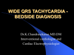 wide qrs tachycardia