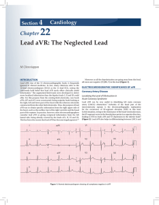 Lead aVR: The Neglected Lead - The Association of Physicians of
