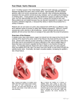 Fact Sheet: Aortic Stenosis