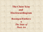 The Chest Xray and Electrocardiogram