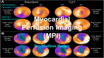Myocardial Perfusion Imaging (MPI)