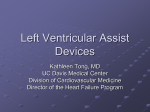 Left Ventricular Assist Devices