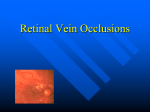 Retinal Vein Occlusions - Kashyap Memorial Eye Hospital