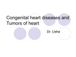Congenital heart diseases