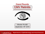 CMV-Retinitis - University of Louisville Ophthalmology
