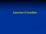 crossbite