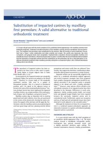 Substitution of impacted canines by maxillary first