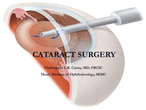 cataract surgery - healthstatistics