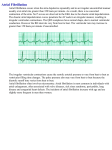 Atrial_Fibrillation